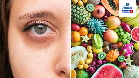 Dark Circles