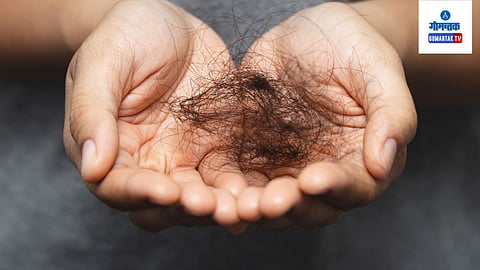 Control Hair Fall: