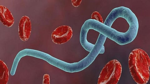 Ebola Virus