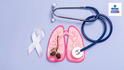 Tuberculosis Cases Goa:  जानेवारी ते सप्टेंबर दरम्यान १,५३२  क्षय रोगाची प्रकरणे नोंदवली गेली