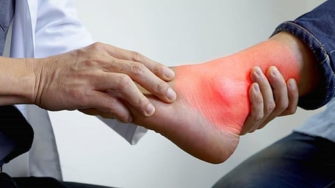 Uric Acid: प्रोटीन्स वाढवतात यूरिक अ‍ॅसिड? जाणून घ्या नियंत्रणात ठेवण्यासाठी कोणत्या गोष्टी खाव्यात