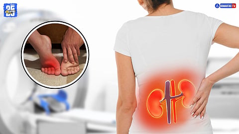 Kidney Damage Symptoms