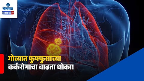 Lung Cancer Cases Increasing in Goa