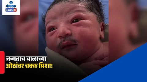 Newborn baby with moustache viral video