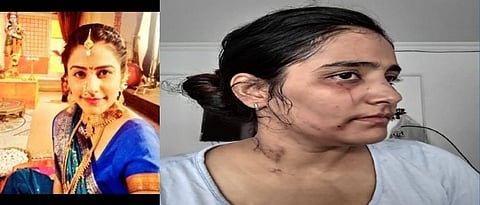  Actress Preeti Talrejaya raised her voice against conversion