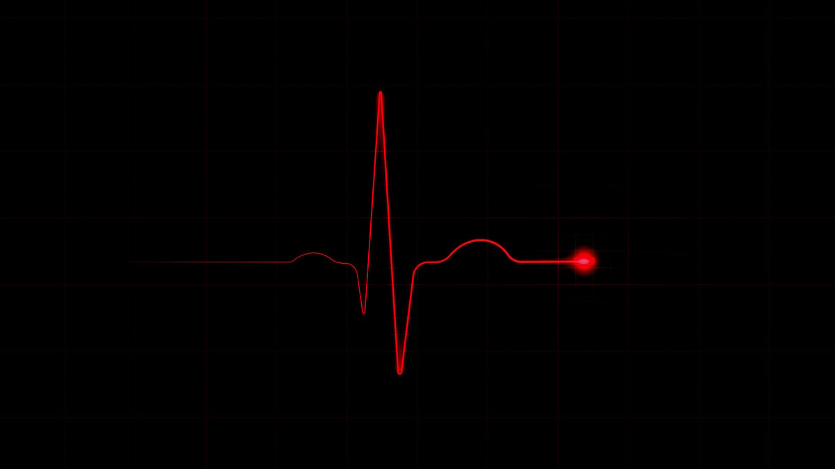 Heart attack has a new definition in a major upgrade