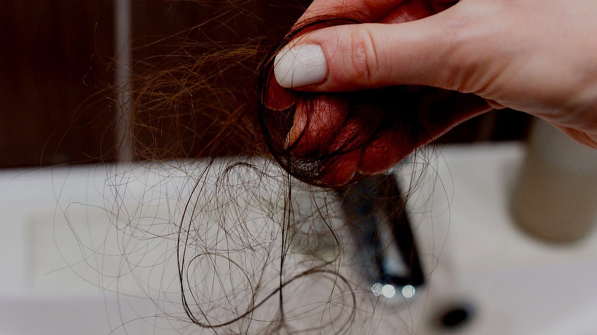 Social media is making youngsters feel their hair needs extreme treatments, warns experts
