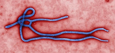 The picture shows the Ebola virus. More than 60 percent of the emerging infectious diseases are zoonotic. Though Ebola and Zika have come to our notice, others like the Rift Valley fever and Lassa fever are predicted to spread with changing environmental factors
Credit: CDC Global/Flickr
