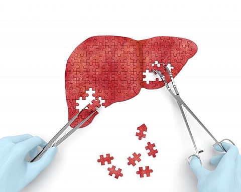 When the dietary source of blood glucose, carbohydrates, is scarce, the liver can produce it with the aid of fat
Credit:iStock