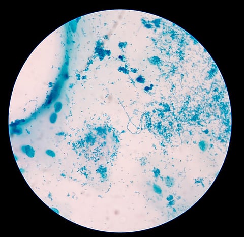 The growing antibiotic resistance in bacteria is a cause of health concern globally (Representative Image from iStock Photos) 