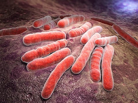 Globally TB still kills more people each year than any other infectious disease (Credit: iStock) 