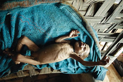 नाम:बेबी,
उम्र: ११ महीने,
वजन:3.4 किलो