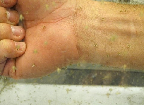 Today, NTDs flourish in places where sub-standard housing, lack of access to safe water and sanitation, chronic hunger, filthy environment, and insects contribute to their efficient transmission
Credit: US Army Africa/Flickr