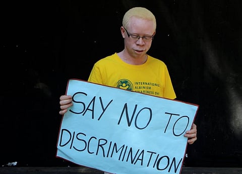 Witchcraft related beliefs pose serious human rights violations for people with Albinism