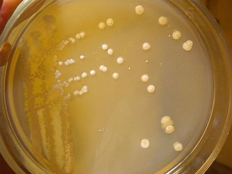 The bacterium belonged to Streptomycetaceae family of bacteria, predominantly found in soil and decaying vegetation (Via Wikimedia Commons) 