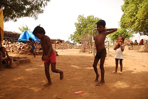 21 per cent children in India, younger than the age of five, suffer from wasting (Credit: Kumar Sambhav Shrivastava/CSE)