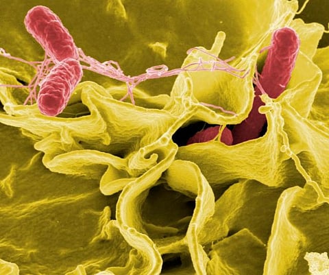 Salmonella Credit: Wikimedia Commons