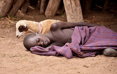 A malaria patient in Ethiopia  Credit: WIkimedia