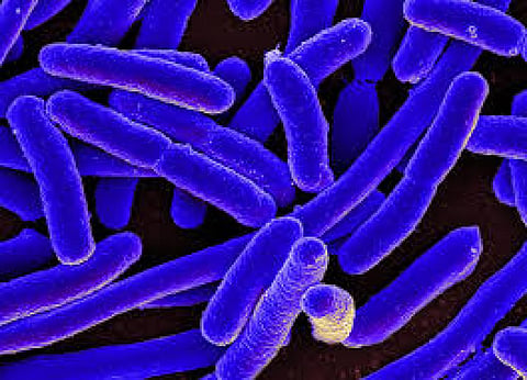 Inflammation is a vital part of the body's immune response. It is the body's attempt to heal itself after an injury; defend itself against foreign invaders, such as viruses and bacteria; and repair damaged tissue. Credit: Pxhere