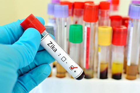 Zika virus spreads through the same mosquitoes who transmits other disease like dengue and chikungunya. Credit: Getty Images