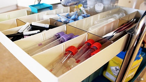 The instruments that use light sensors for diagnostics are called photo plethysmograph
(PPG) devices.. Ccredit: Wikimedia Commons