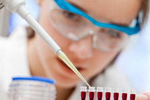 The blood test still has to undergo further testing before it is made available to the public. Credit: Getty Images