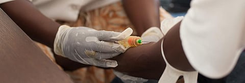 About 1.5 billion people are infected with NTDs worldwide, with Africa accounting for nearly 40 per cent. Credits: Getty Images