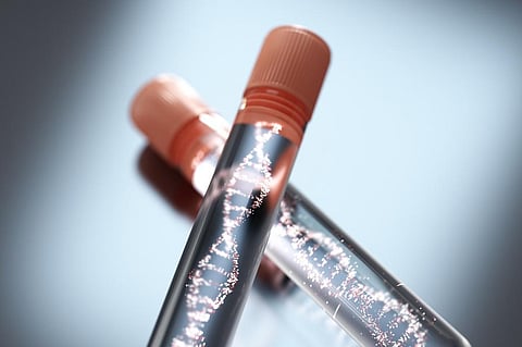 Genes might be useful while treating kidney diseases