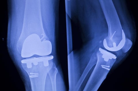 New materials may make implants safe
