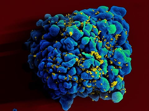 In a first, immunotherapy that pulls HIV virus out of hiding to kill it 