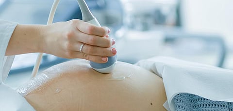 A doctor performs a sonogram on a pregnant woman. Photo: Getty Images