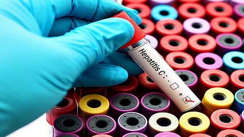 How liver protein can aid in developing vaccine for hepatitis C 