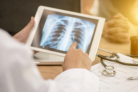 Scientists identify new route to tackle TB 