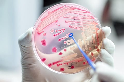 New nanosilver coating that can kill bacteria developed