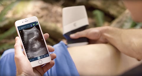 Photo : Clarius Mobile Health

