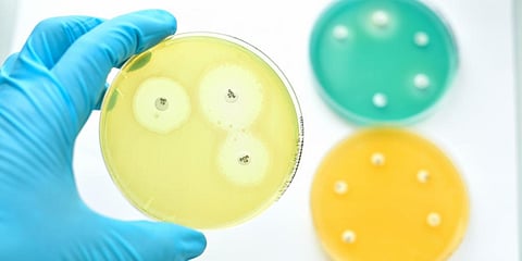 A test for antimicrobial resistance. Photo: Getty Images