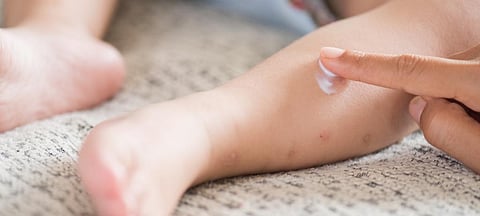 Children under the age of one get infected by the virus the most in India as they have the highest incidence rate of 76.4 per million population. Photo: Getty Images