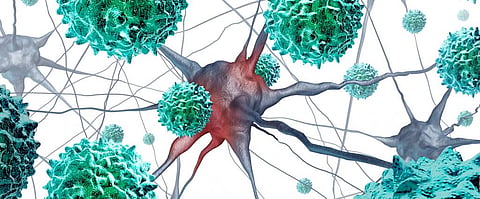 AFM cases not polio-like, says CDC