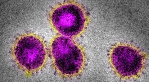 Coronavirus mutated, new strain more aggressive: Research