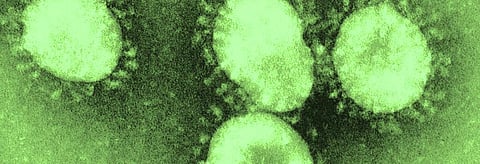 Coronavirus update: CNN pegs US tally at 13,000