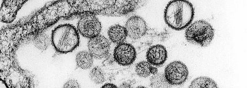 China reports Hantavirus infection