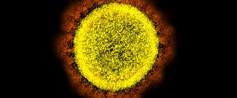 Transmission electron micrograph of the novel coronavirus (SARS-CoV-2) particles, isolated from a patient Photo: NIAID/Flickr