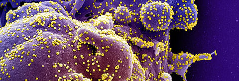 COVID-19: New tool through CRISPR tech to aid quicker coronavirus tests