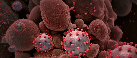 Three distinct immune responses to SARS-CoV-2 have been identified in 2 US studies. Photo: Flickr
