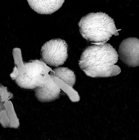 ‘Wrap, trap, zap’: New strategy to kill antibiotic resistant bugs in wastewater