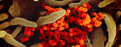 Chloroquine does not inhibit SARS-CoV-2 spread in human lung cells: Study