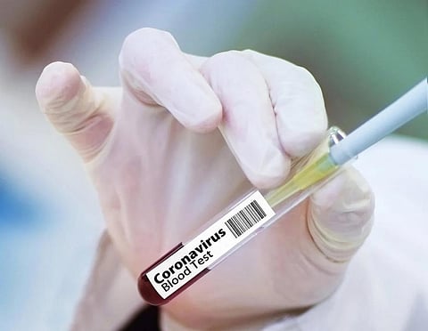 COVID-19 vaccine development: It’s a relay race  
