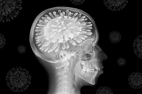Coronavirus: The pandemic is changing our brains – here are the remedies