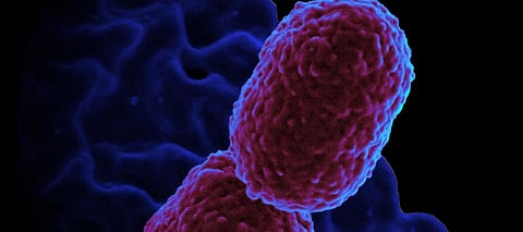The case of anti-microbial resistance: Adding worry to the woes of COVID-19 pandemic
