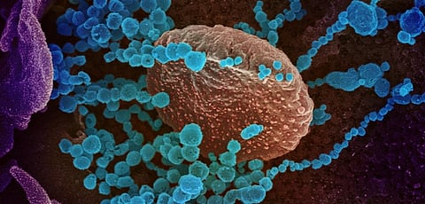 Coronavirus update: India GDP contracted nearly 24% in April-June